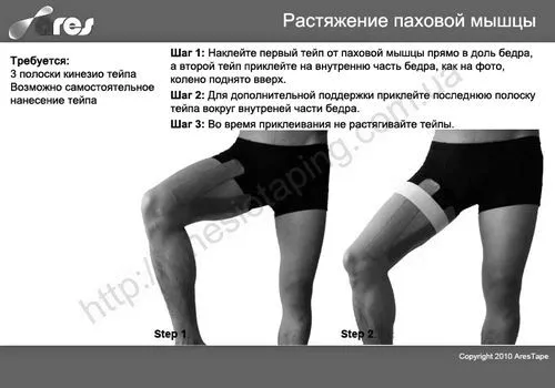 як лікувати розтягнення паху