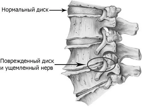 поширений