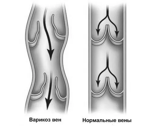 лікування