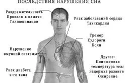 безсоння