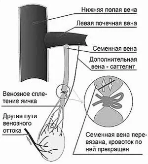 симптоми