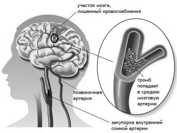 піхви