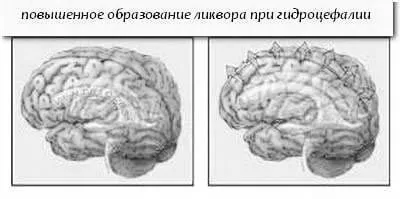 немовлят