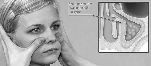 хронічний