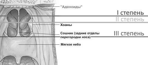 мигдалини