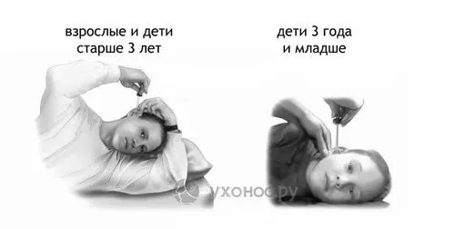 як лікувати отит без ліків