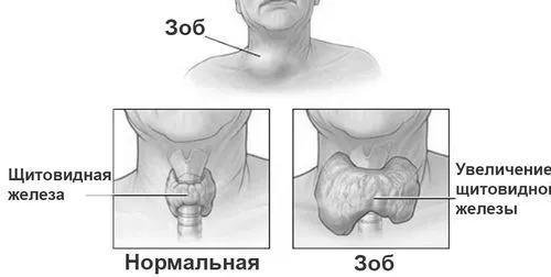 симптоми