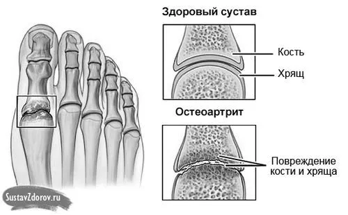 великого