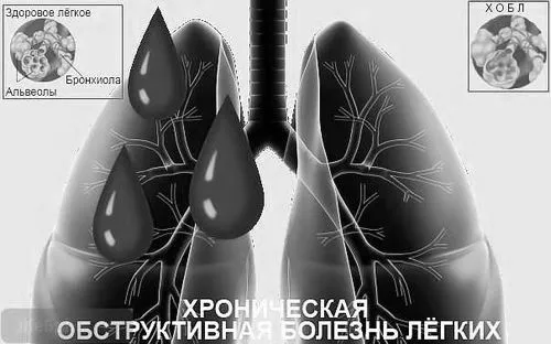 задишка