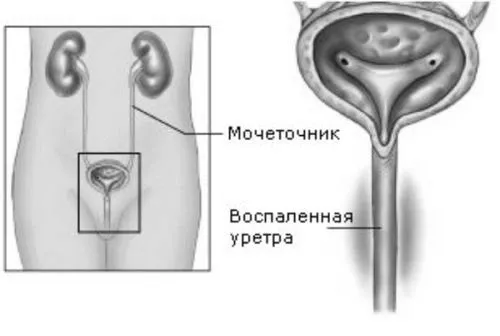 ворожіння