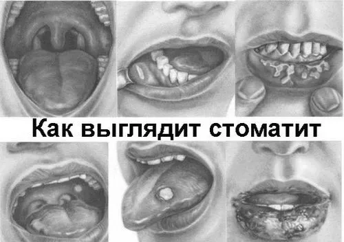 хвороби