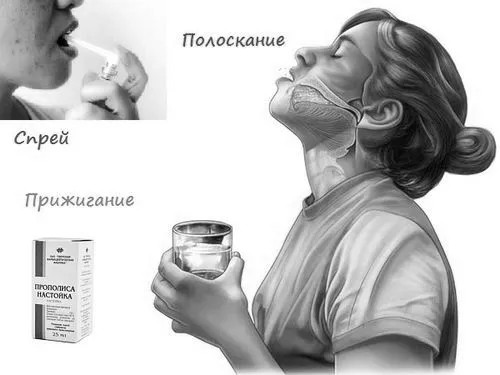 лікувати