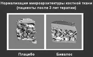 Бівалос інструкція із застосування ціна аналоги
