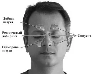 ознаки гаймориту