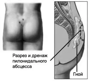лікування