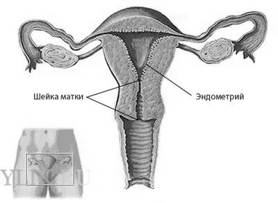 матка