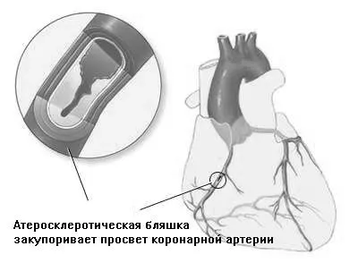 лікування