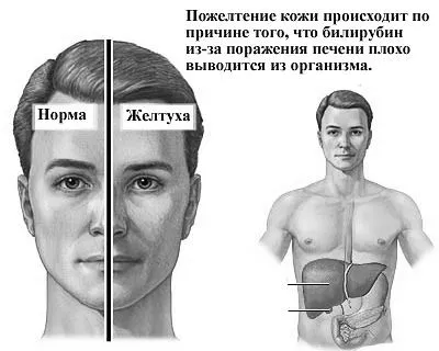 лікування