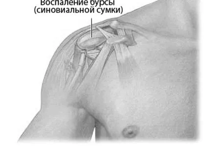 колінного
