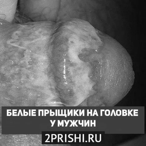 білі