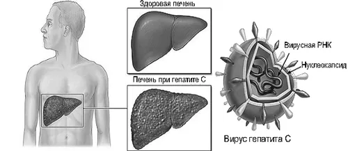печінка