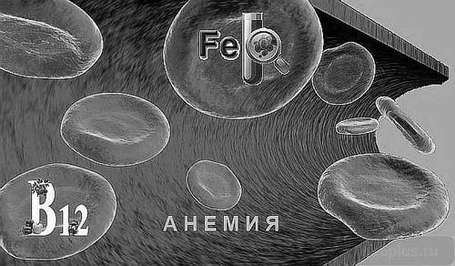 хвороба анемія