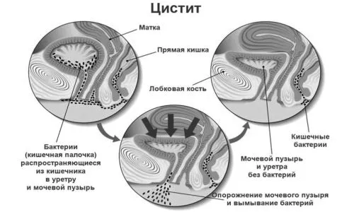 симптоми