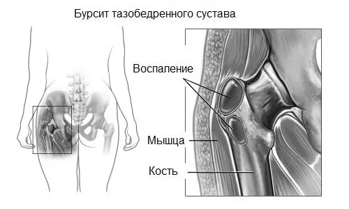 симптоми