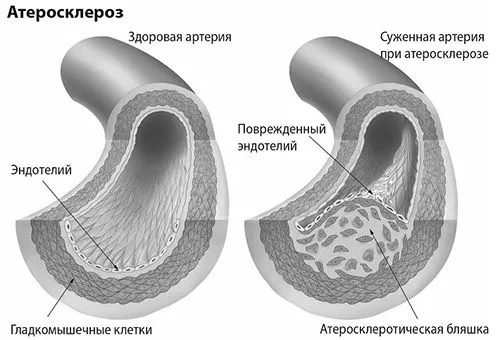 судин