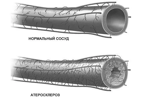 судин