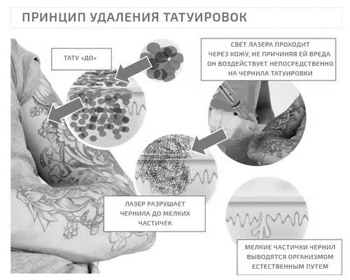 як лікувати алергію на тату