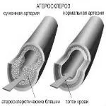 лікування