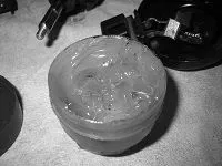 псоріаз