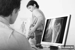 як лікувати бурсит тазостегнового суглоба