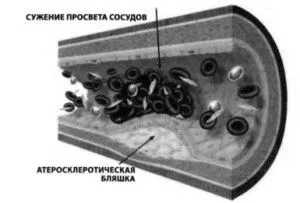 частка