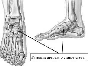 деформуючий