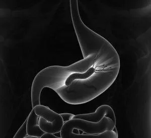 хелікобактер пілорі helicobacter pylori лікування антибіотиками схема