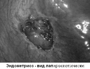 захворювання шлунково-кишкового тракту