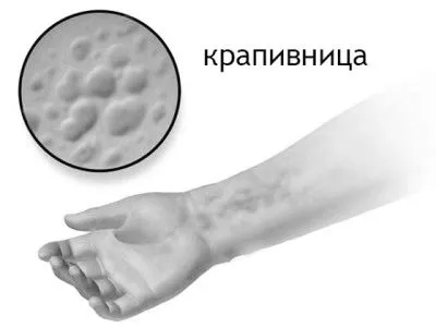 янка