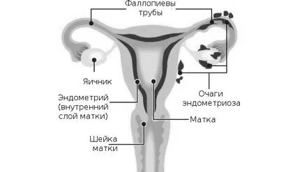 лікування