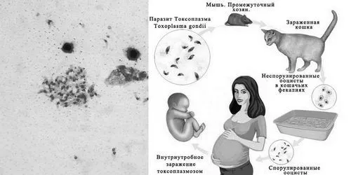 Що таке токсоплазмоз: симптоми, діагностика та лікування, наслідки хвороби токсоплазмоз
