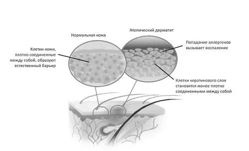 лікування