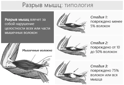 розрив