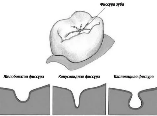 лікування