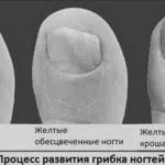 лікування