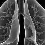 як вилікувати гикавку