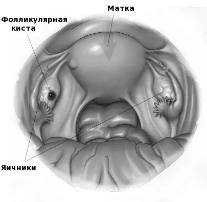 лікування