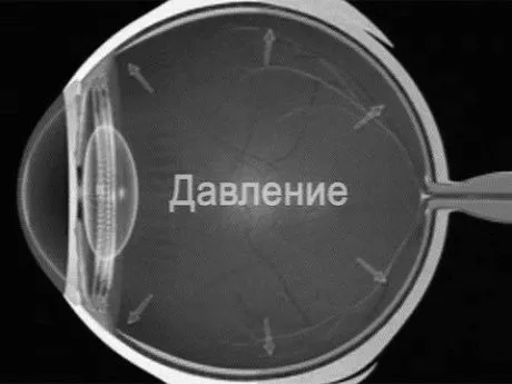 причини