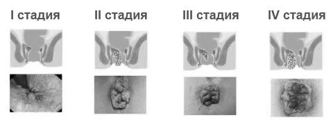 лікування. будинки