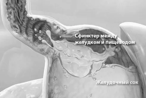 позбутися